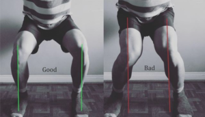 Two pictures demonstrating proper knee alignment during squats.